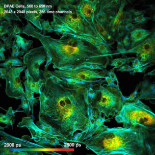 photon counting microscope picture.